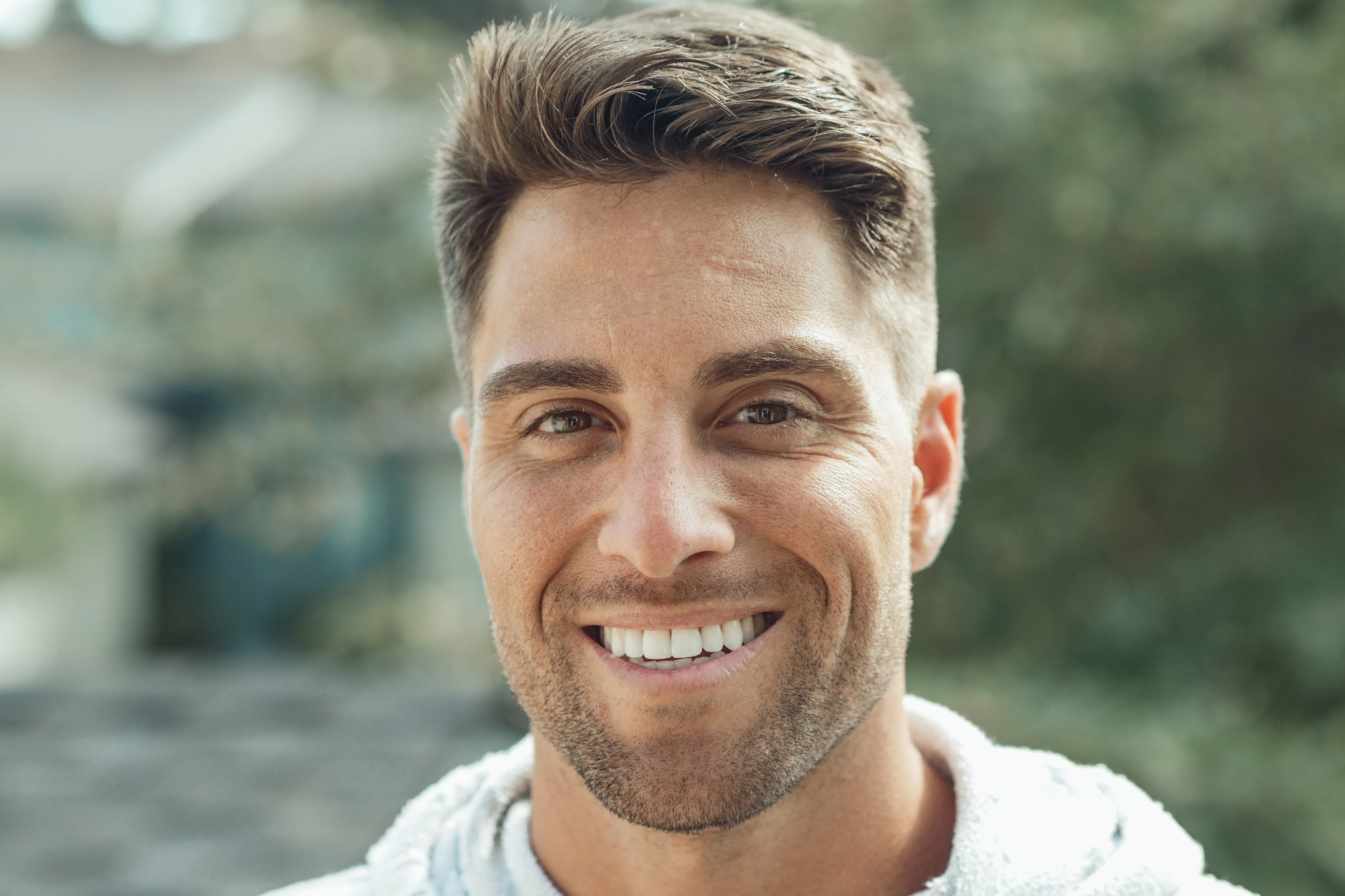 Smile Makeover